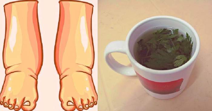 Ceaiuri pentru picioare umflate şi dureroase