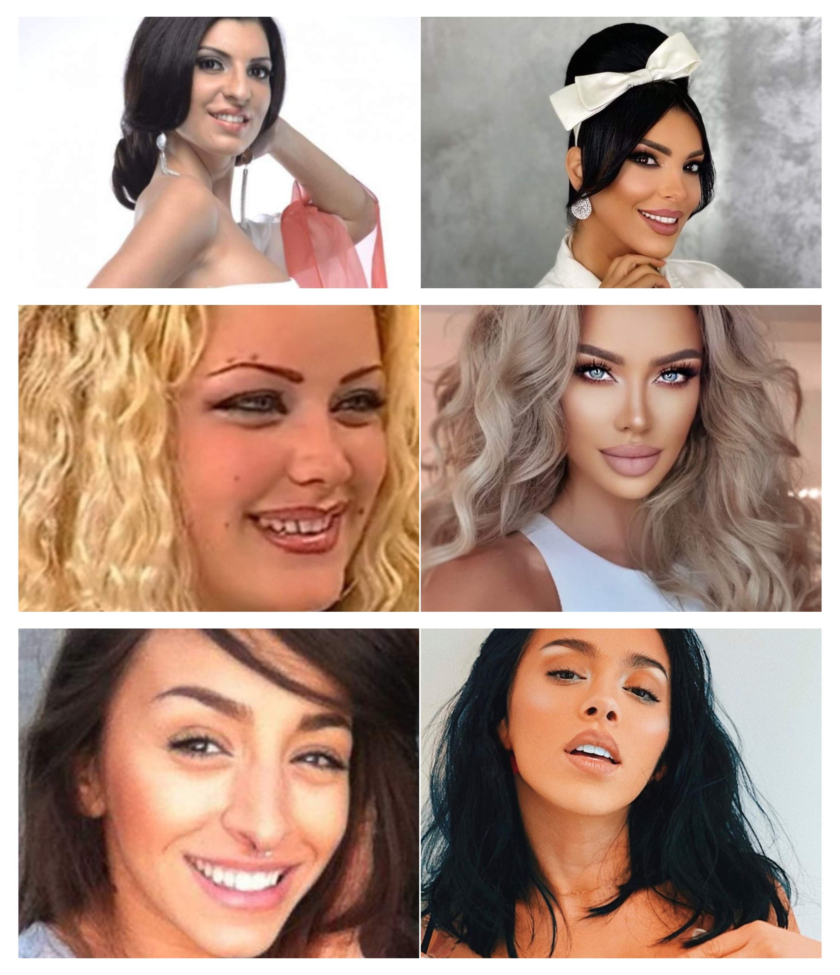 Colaj cu Andreea Tonciu, Bianca Drăgușanu și Ruby înainte și după rinoplastie.