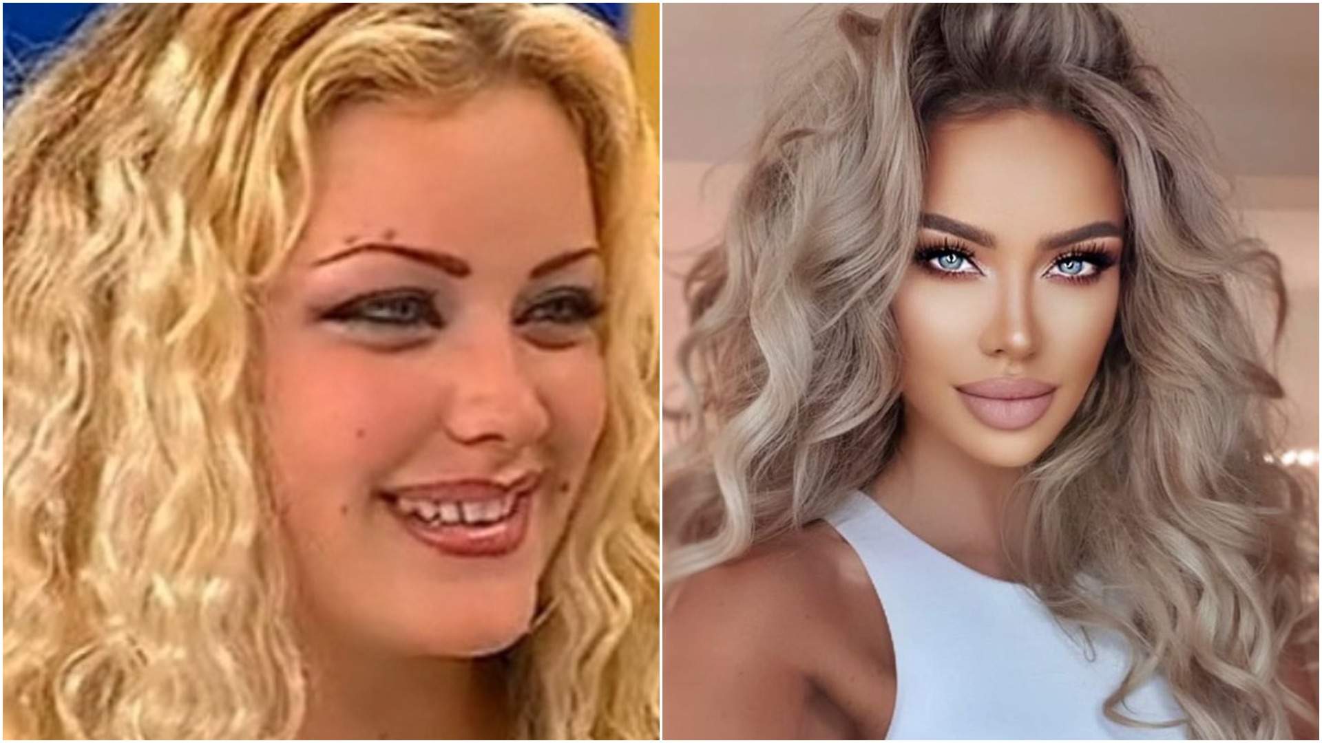 Bianca Drăgușanu înainte și după operații estetice!