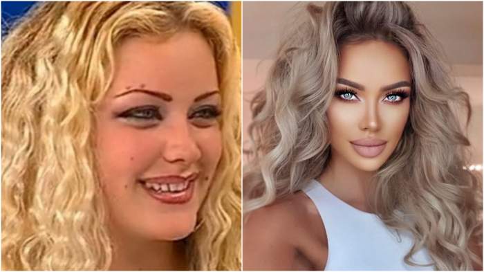 Bianca Drăgușanu înainte și după operații estetice!