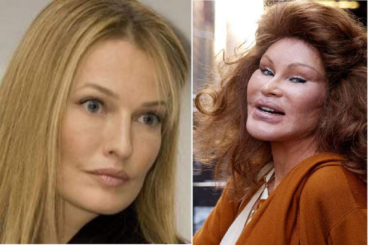 Jocelyn Wildenstein Desfigurată Din Cauza Operațiilor Estetice Femeia și A Distrus Chipul Pentru Fostul Soț Spynews Ro