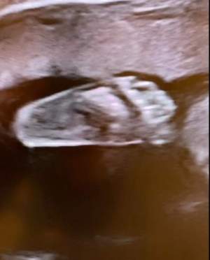 Gina Pistol a făcut publică prima fotografie cu micuța din burtică. Prezentatoarea a ajuns în trimestrul al doilea de sarcină / FOTO