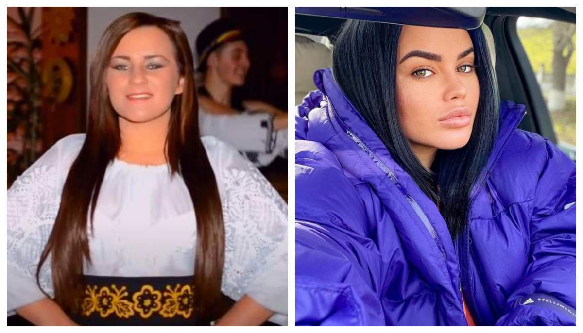 Carmen de la Sălciua, înainte și după operațiile estetice