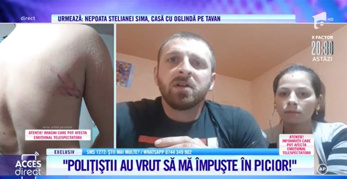 Acces Direct. Un bărbat a fost bătut crunt de trei polițiști, pe motiv că i-ar fi jignit pe Facebook. Ce a avut tânărul de îndurat / VIDEO