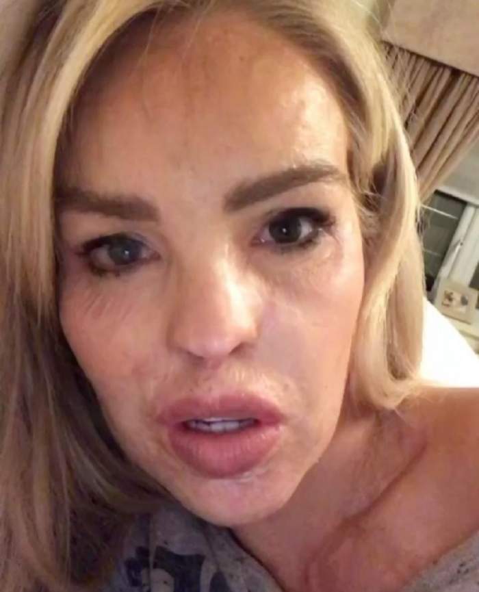 Katie Piper sta in pat, are parul desprins si vorbeste