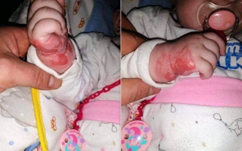 Imagini revoltătoare! Un bebeluş de cinci luni din Hunedoara s-a ales cu răni grave, după ce a fost tratat de răceală