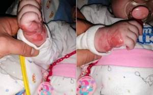 Imagini revoltătoare! Un bebeluş de cinci luni din Hunedoara s-a ales cu răni grave, după ce a fost tratat de răceală