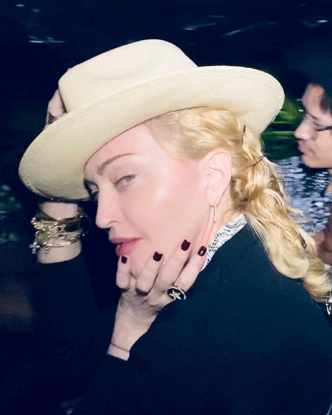 FOTO / Madonna, probleme grave de sănătate. Vedeta a ajuns să meargă cu ajutorul bastonului
