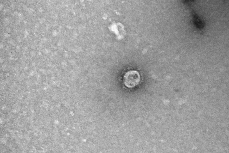 Cum arată COVID-19 văzut la microscop! Așa arată virusul care a ucis mii de oameni