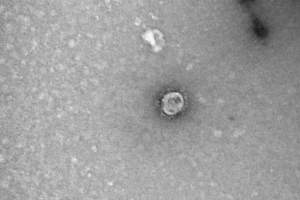 Cum arată COVID-19 văzut la microscop! Așa arată virusul care a ucis mii de oameni