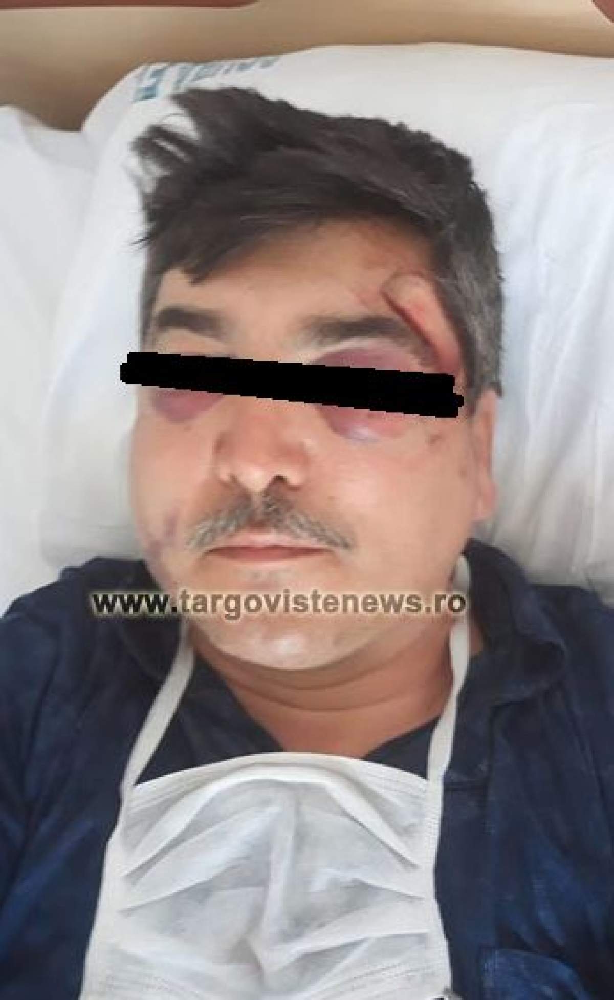 Un bărbat a fost bătut și tăiat cu sabia la Nucet. Agresorii s-au enervat după ce victima a dat cu mașina peste sticlele lor de bere