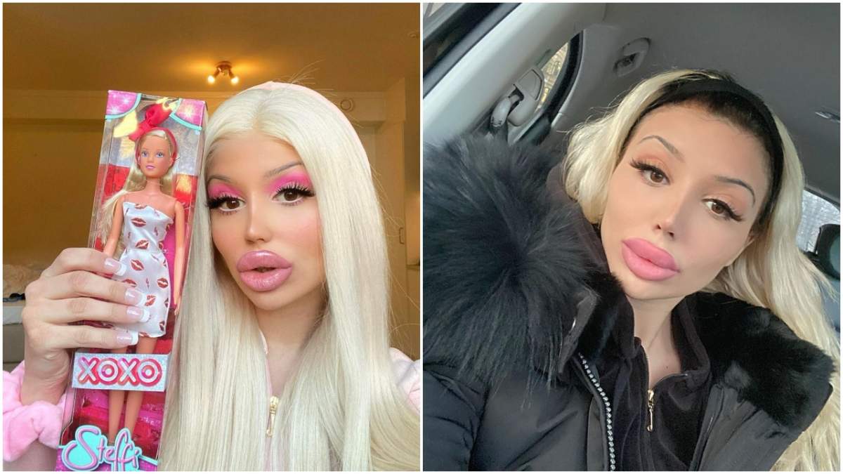 Din cauza pandemiei, o tânără „Barbie” a învățat să își mărească singură buzele! Incredibil cum arăta acum 5 ani / FOTO