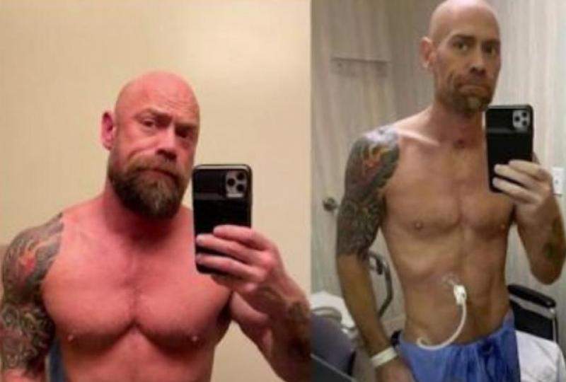 FOTO / Transformare șocantă a unui bolnav de COVID-19! Cum a ajuns să arate bărbatul, după ce a fost chinuit șase săptămâni de virusul ucigaș