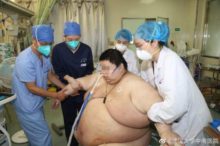 Bărbatul care s-a îngrășat 100 kg în carantină! Cum a ajuns să arate cel care i-a uluit pe medici / FOTO