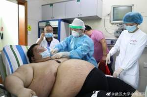 Bărbatul care s-a îngrășat 100 kg în carantină! Cum a ajuns să arate cel care i-a uluit pe medici / FOTO