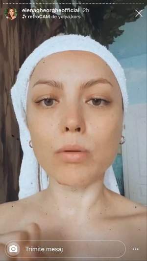 FOTO / Elena Gheorghe, probleme grave din cauza măștii de protecție! Cum a avut de suferit tenul artistei. „Voi merge la un dermatolog, nu e de joacă”
