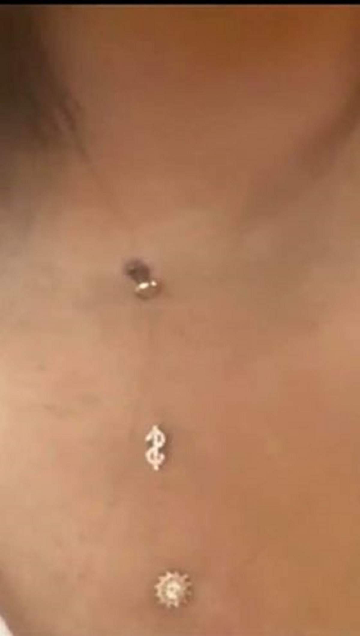 Cardi B, probleme de sănătate din cauza piercing-urilor! Cum arată cântăreața după ce corpul i-a respins accesoriile / FOTO