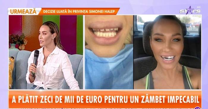 Raluca Podea a rămas fără dinți! Probleme grave de sănătate pentru vedetă! Imagini șocante! ”A început calvarul”