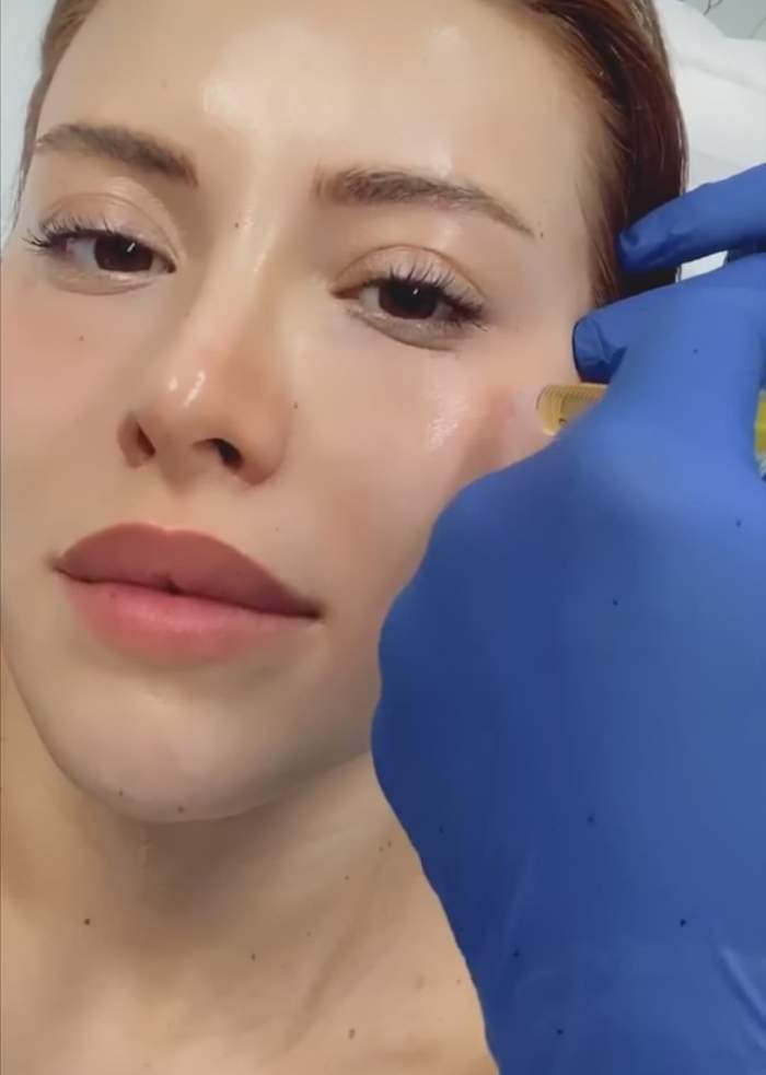 Nicoleta Nucă a ajuns pe mâna medicilor. După operația la nas, artista își face alte schimbări acum / FOTO