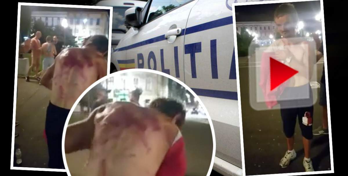 VIDEO / Tânăr fără o mână, mutilat în bătaie, de polițiști / A amenințat că își va face singur dreptate