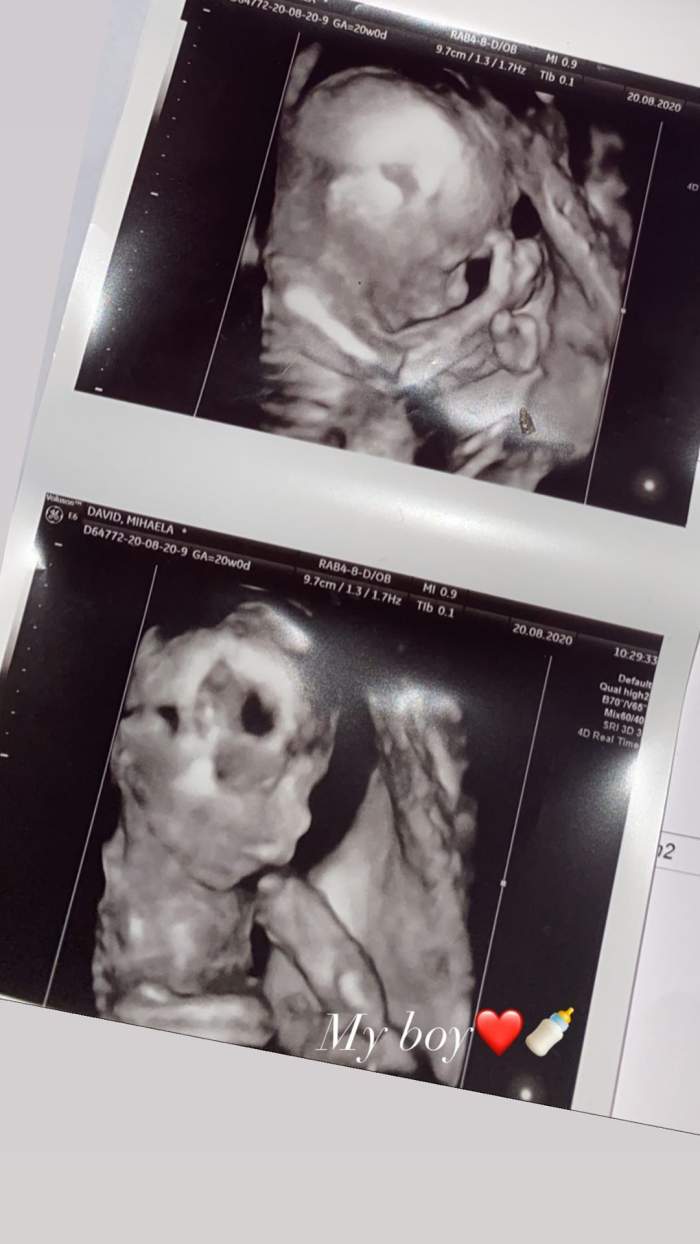 Fiul lui Florin Salam a postat ecografia băiețelului său! Prima fotografie cu cel mic / FOTO