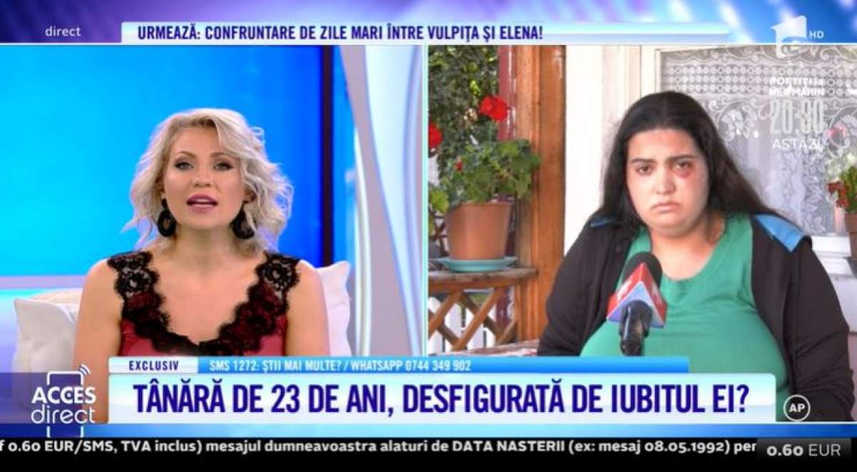 Tânără de 23 de ani, desfigurată în bătaie de iubit! Elena Vasile se teme pentru viața ei: ”Nu este prima oară când m-a lovit” / VIDEO 