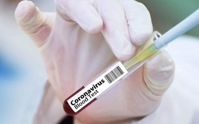 Vaccinul pentru coronavirus. Cum va ajunge la cei șapte miliarde de locuitori ai globului