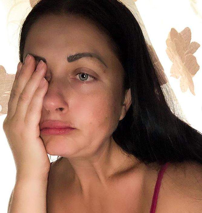 Gabriela Cristea cu fața desfigurată! Cum a apărut vedeta pe rețelele de socializare / FOTO