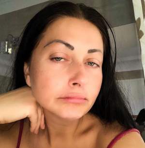 Gabriela Cristea cu fața desfigurată! Cum a apărut vedeta pe rețelele de socializare / FOTO