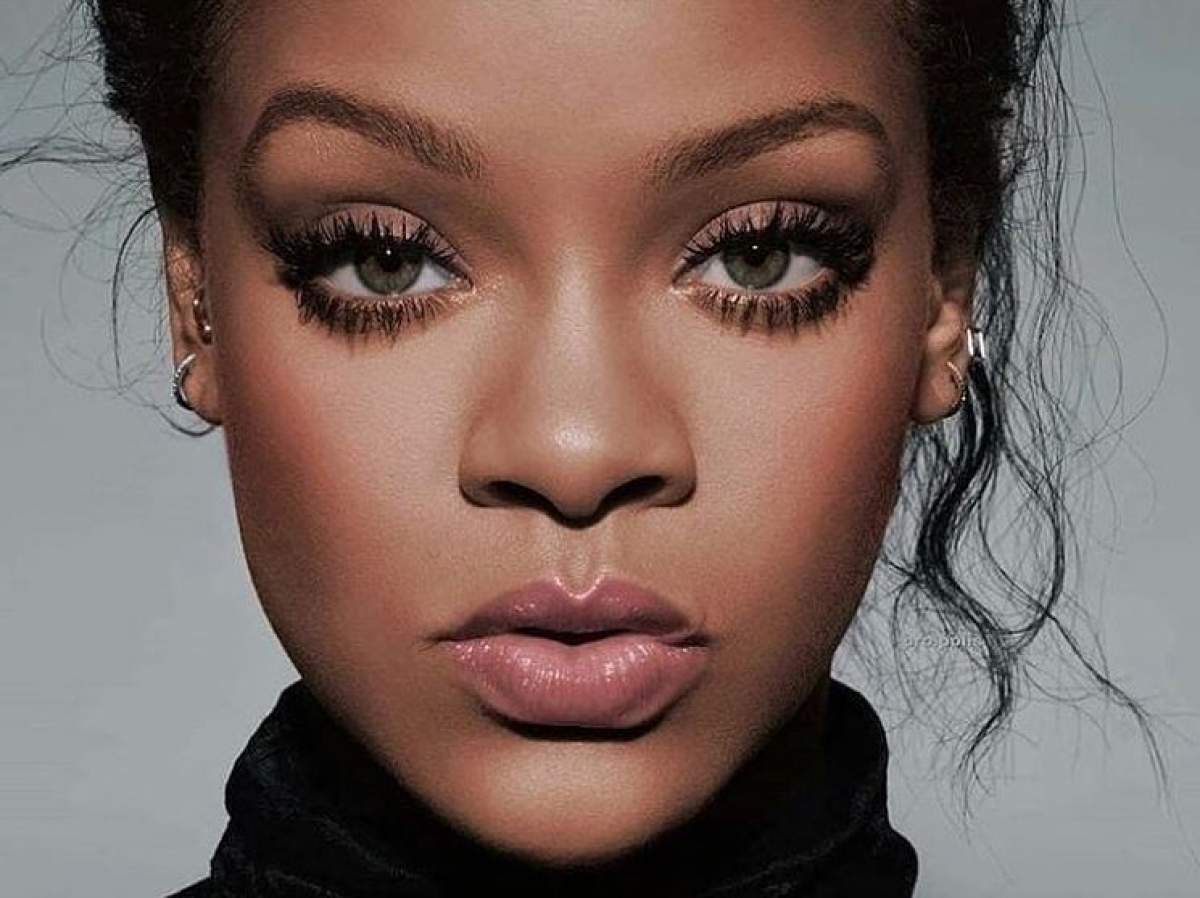 Rihanna, cu vânătăi și zgârieturi pe față