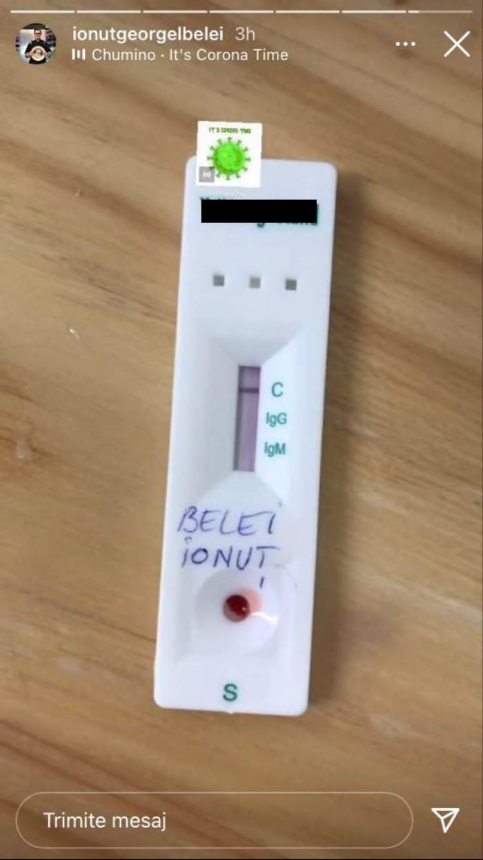 Ionuț Belei le-a arătat fanilor de pe Instagram rezultatul testului pentru coronavirus