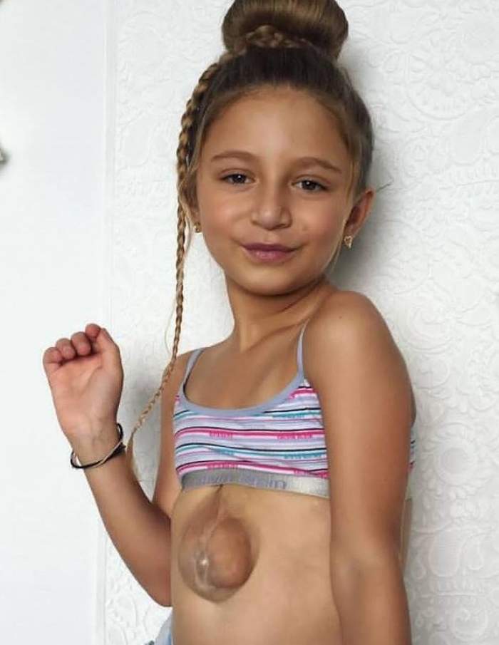 Cum arată fetița din Rusia născută cu inima în afara corpului! Virsaviya are acum 11 ani și este un adevărat fenomen: „Sunt o inspirație” / FOTO