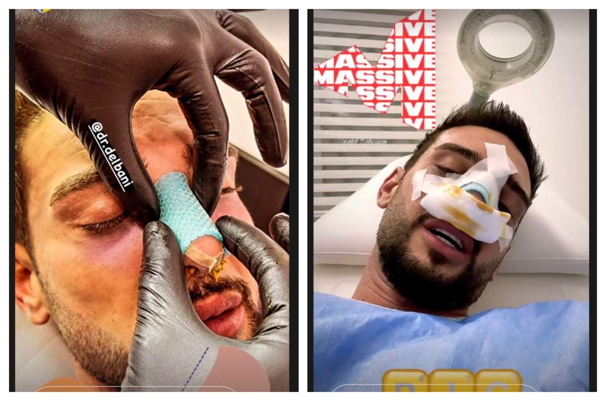 Dorian Popa, direct pe masa de operație. Imaginile care au îngrijorat fanii / VIDEO