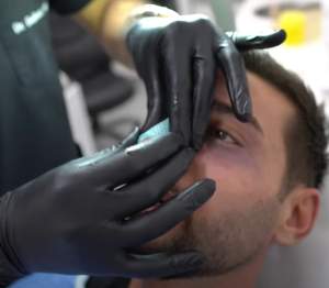 Cum arată Dorian Popa, după ce și-a ”operat” nasul! Intervenția a luat prin surprindere pe toată lumea. ”Sunt curios ce vor zice” / VIDEO