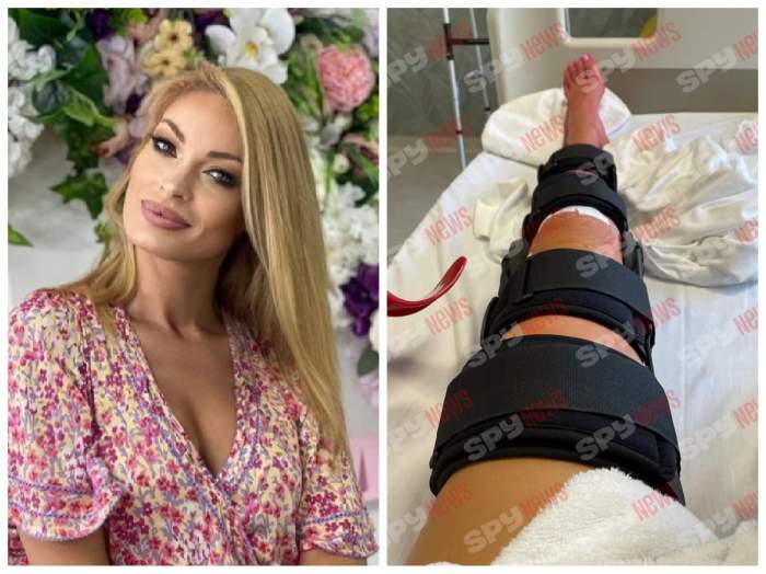 Valentina Pelinel, picior după operație, colaj