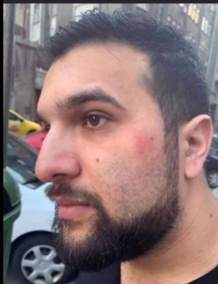 Tzancă Uraganu a fost bătut cu bestialitate! Imagini dramatice cu celebrul manelist / FOTO