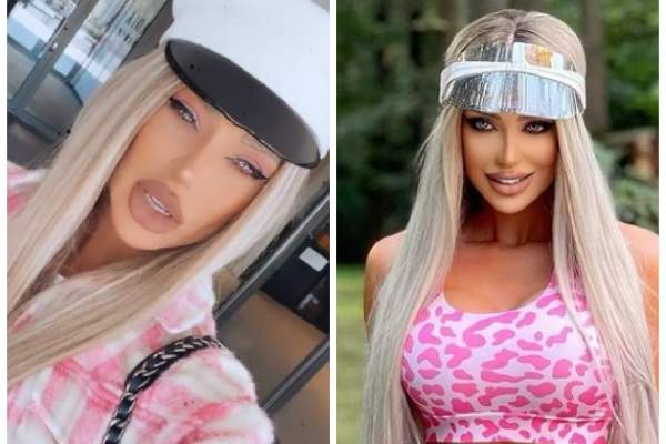 Bianca Drăgușanu își face noi intervenții estetice. Blondina a ajuns la medic pentru retușuri la nivelul feței: „A trecut vara ...”
