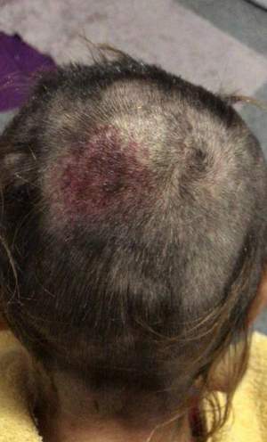 O femeie din Bihor a fost bătută și sechestrată de către copiii patronului firmei la care lucra: “I-au spart capul și au tuns-o” / FOTO