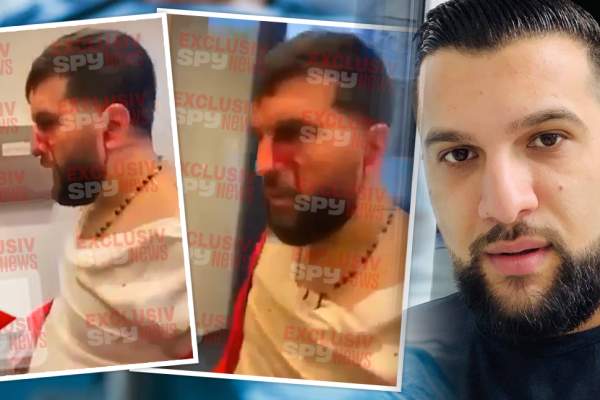 Tzancă Uraganu, plin de sânge și cu fața tumefiată! Primele imagini cu artistul imediat după ce a fost bătut / EXCLUSIV