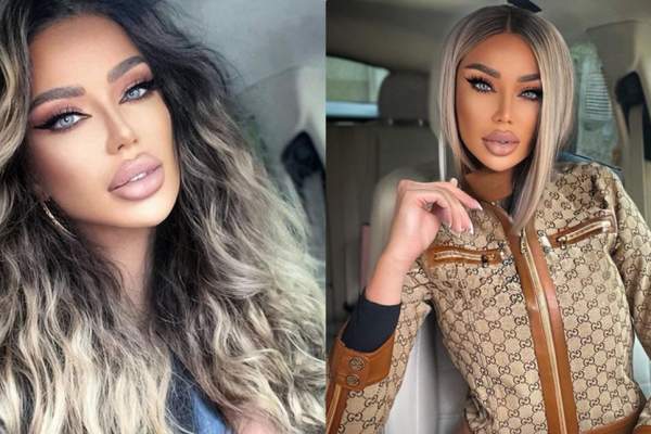 Bianca Drăgușanu, o nouă intervenție estetică. Ce schimbare are de gând să-și mai facă: ”Mă deranjează”