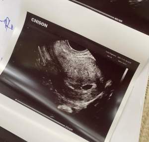 Haziran, iubita lui Luis Gabriel, este însărcinată! Blondina a postat și prima fotografie cu bebelușul: ”Cei mai fericiți oameni de pe pământ” / FOTO