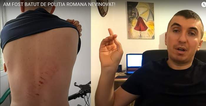 Vlogger celebru: „Polițiștii m-au bătut, fiindcă i-am ajutat să prindă un infractor!” / Încătușat, răpit și torturat, până când a cerșit milă