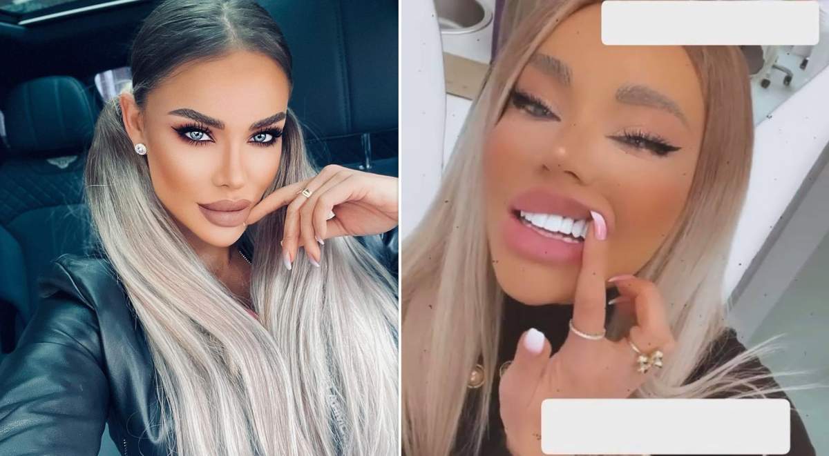 Cum își modifică Bianca Drăgușanu caninii Cum își modifică Bianca Drăgușanu caninii