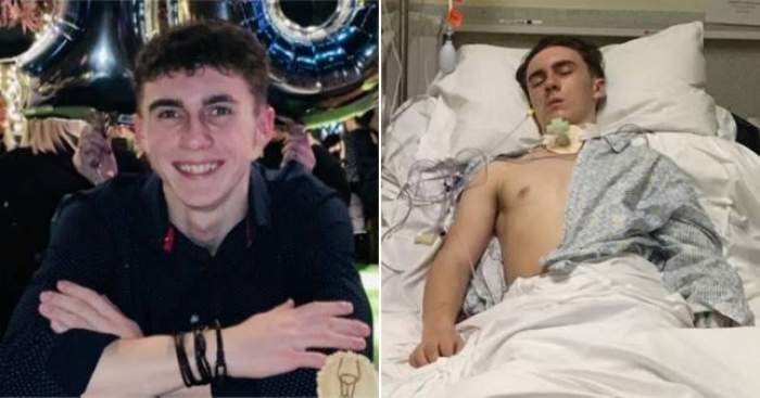 Un tânăr de 19 ani s-a trezit după aproape un an din comă! Adolescentul a avut de două ori coronavirus în tot acest timp