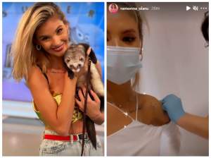 Ramona Olaru, vaccinată de urgență după ce a fost mușcată de un dihor. Asistenta TV a publicat o poză cu rana / FOTO