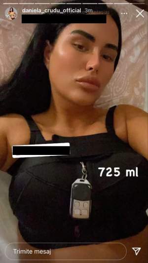 Daniela Crudu, imagini cu sânii de 1 litru de silicon! Cum arată acum bustul brunetei! / FOTO