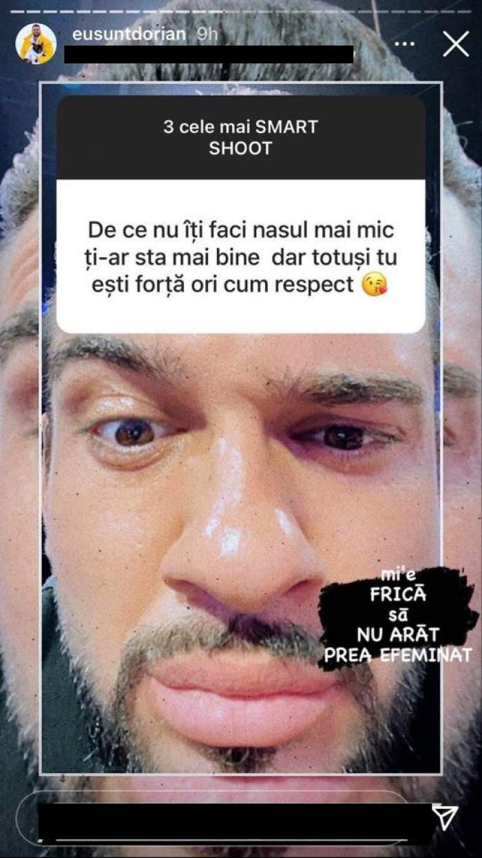 Dorian Popa le-a explicat fanilor de pe Instagram de ce nu și-a micșorat nasul