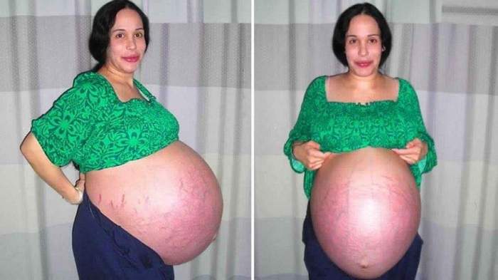 Cum arată femeia care a născut opt bebeluși de-odată! Octomomama are în total 14 copii