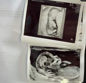 Andreea Popescu va deveni mamă pentru a doua oară. Fosta dansatoare este în luna a treia de sarcină: „Iubirea se înmulțește” / FOTO