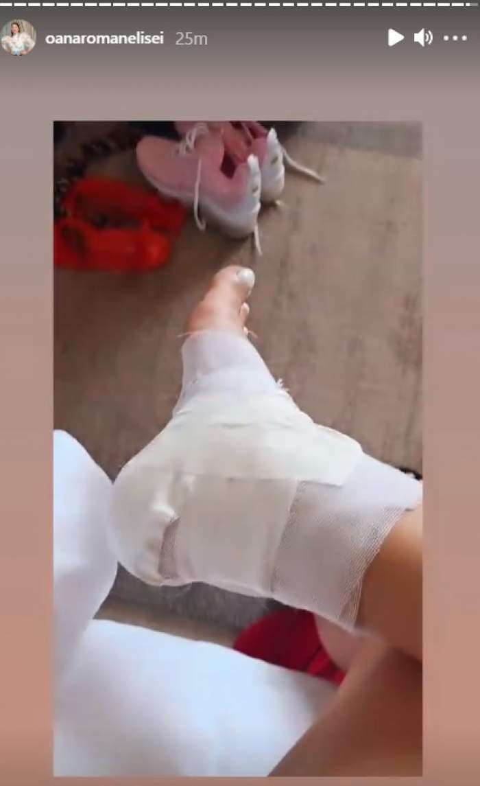 Oana Roman, pe mâna medicului după un accident dureros în vacanță. Ce i s-a întâmplat vedetei: „M-a cusut în călcâi”